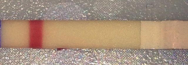 Wondfo Test Strips Pregnancy Test, 11 Days Post Ovulation, FMU