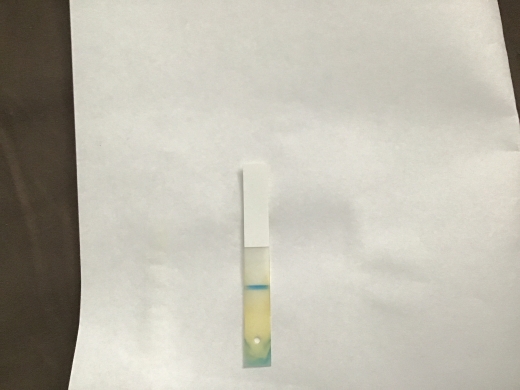 Equate One Step Pregnancy Test, 21 Days Post Ovulation, Cycle Day 32